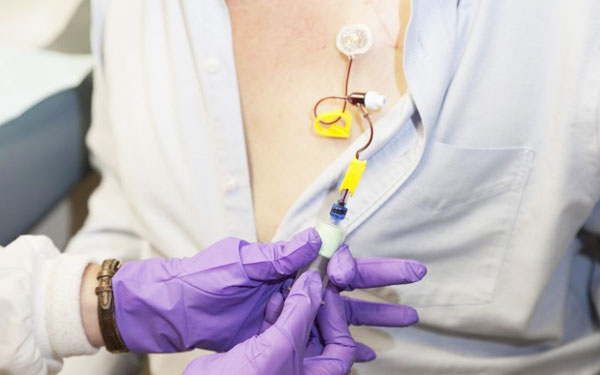 chemo-port-handling-at-home-in-gurgaon