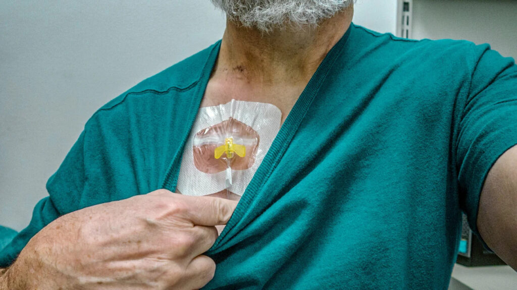 chemo-port-handling-at-home-in-gurgaon