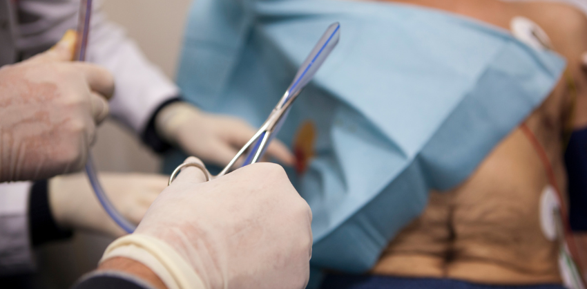 ryles-tube-insertion-at-home-in-gurgaon