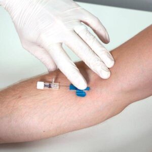 cannula-insertion-at-home